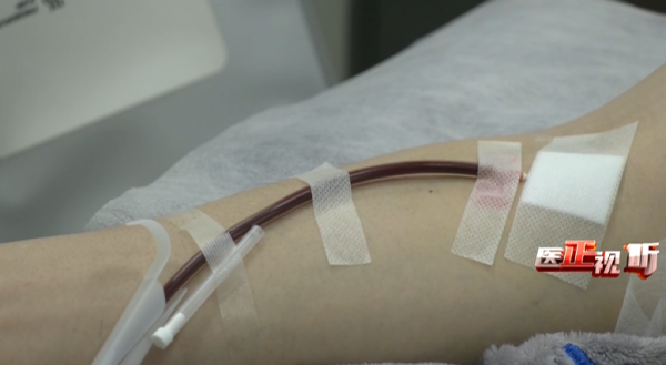 直系親屬之間能輸血嗎？醫生：這種情況下不建議