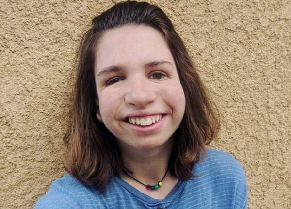 英國男子臉部畸形，憑魅力迎娶美女大學生，孩子出生後笑不出來了