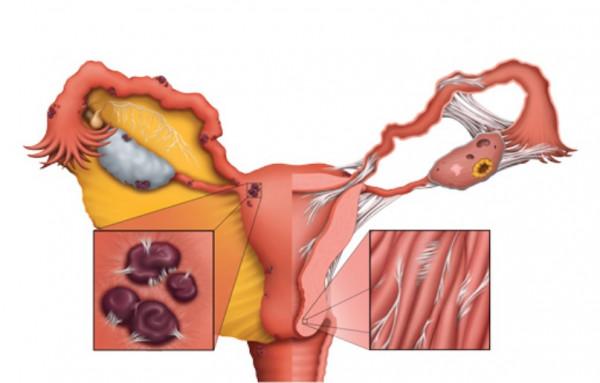 月經異常、小便困難、便秘,可能還與肝有關係 月經異常、小便困難、便秘,可能還與肝有關係