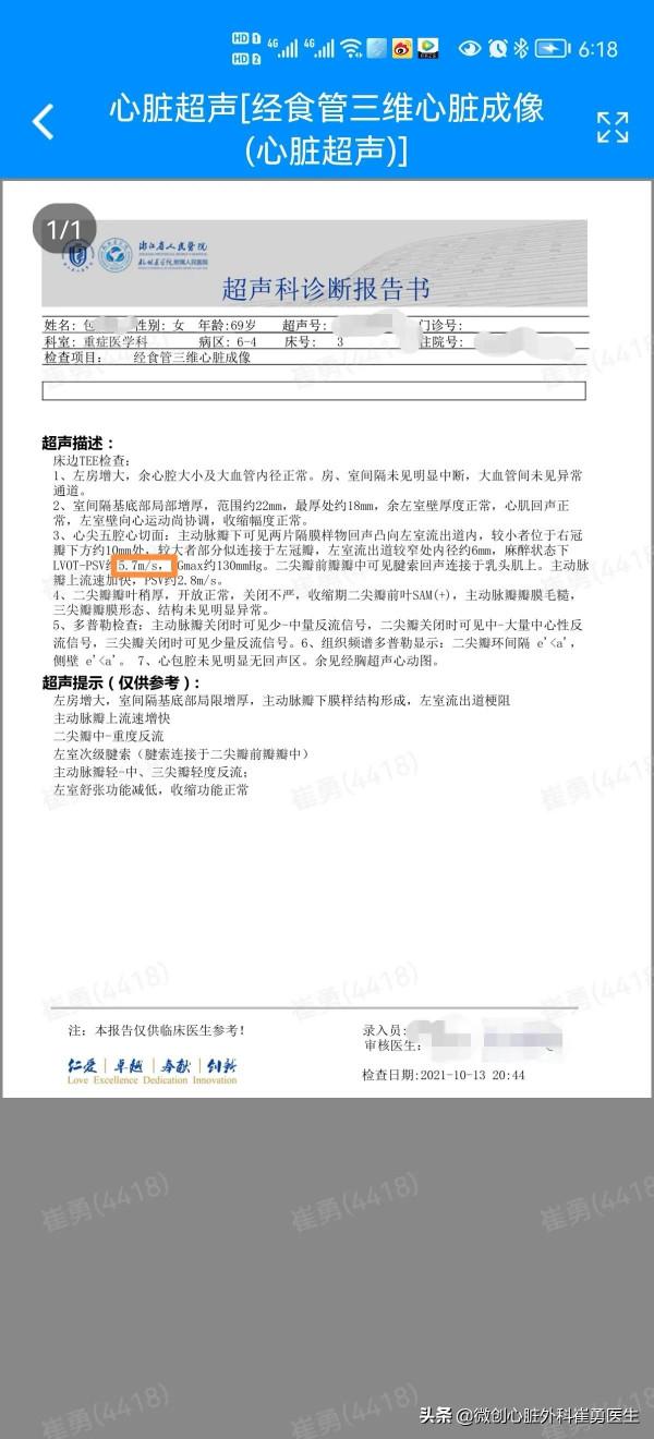 無可見疤痕的微創肥厚梗阻性心肌病手術 無可見疤痕的微創肥厚梗阻性心肌病手術