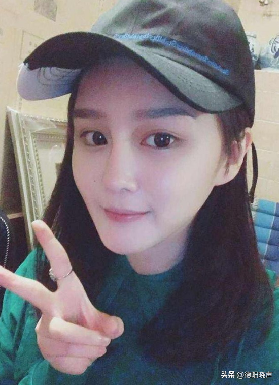 趙本山女兒整容引發老媽不滿，動不動就打針，連發財鼻都整掉了