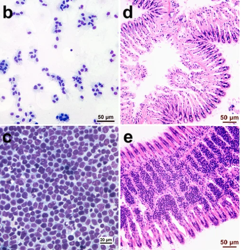 癌症，有時也可以傳染