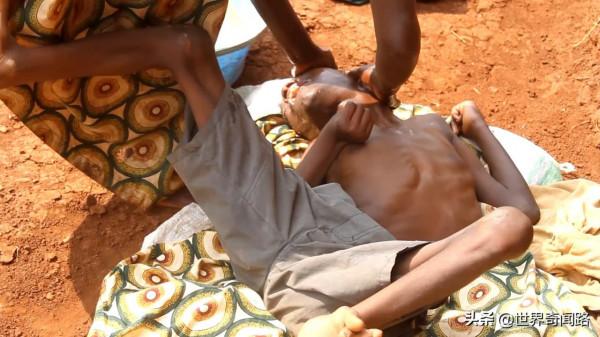 非洲腦癱夫妻結婚27年,每天嘴對嘴餵飯給丈夫,愛情和金錢無關 非洲腦癱夫妻結婚27年,每天嘴對嘴餵飯給丈夫,愛情和金錢無關