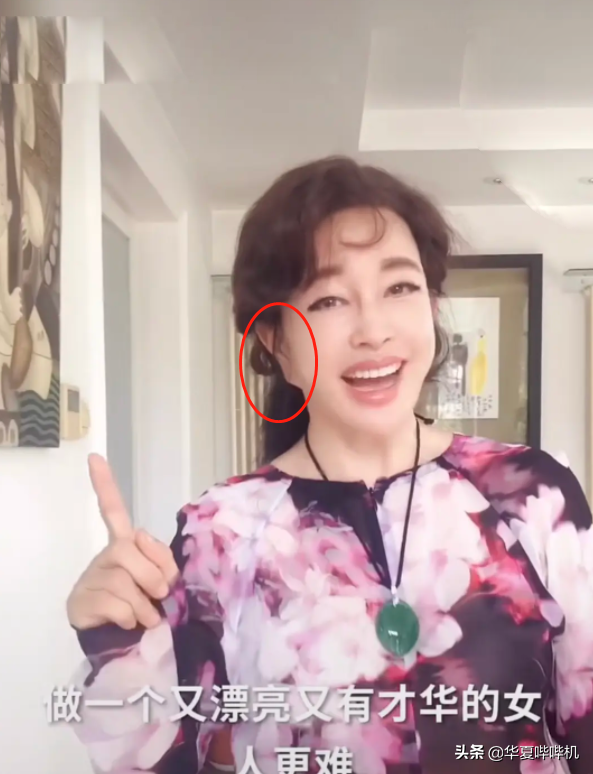 明星大型“翻車”現場，她們是如何整容變毀容的