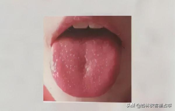 陰虛內熱怎麼辦？有了這兩味中藥，助你養陰生津，清熱涼血