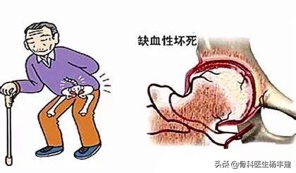 老年養生:骨科醫生常說的這五種骨病,一定要加倍小心 老年養生:骨科醫生常說的這五種骨病,一定要加倍小心