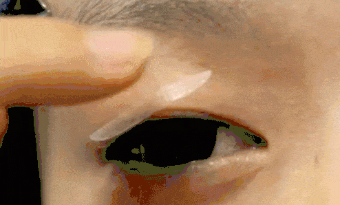 #安心變美課堂##我的安心變美推薦# 眼皮越來越松，怎麼辦？