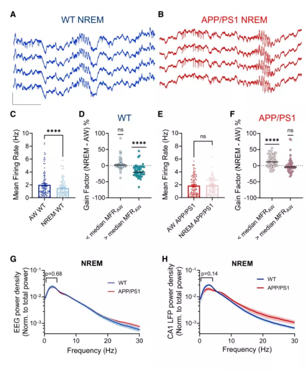 Cell Rep：阿爾茨海默病早期在睡眠時可能存在神經環路功能失調