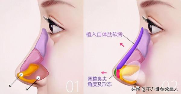 那些亂整鼻子的女明星還好嗎？後遺症一大堆，楊冪金晨都開始崩了