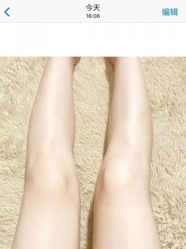 說多少遍了！去關節黑真的不難