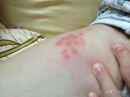 廣東臭蟲,讓人膽戰心驚 廣東臭蟲,讓人膽戰心驚