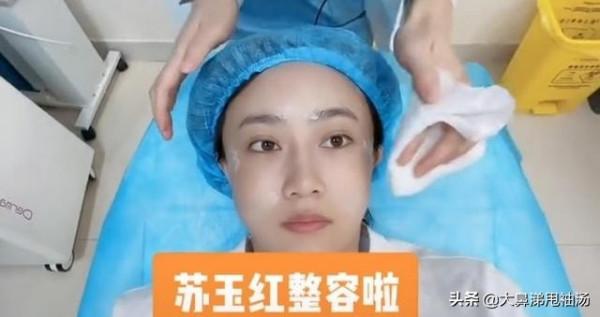 鄉村愛情女演員曬整容全過程,全臉麻醉打針,網友:變化好大 鄉村愛情女演員曬整容全過程,全臉麻醉打針,網友:變化好大