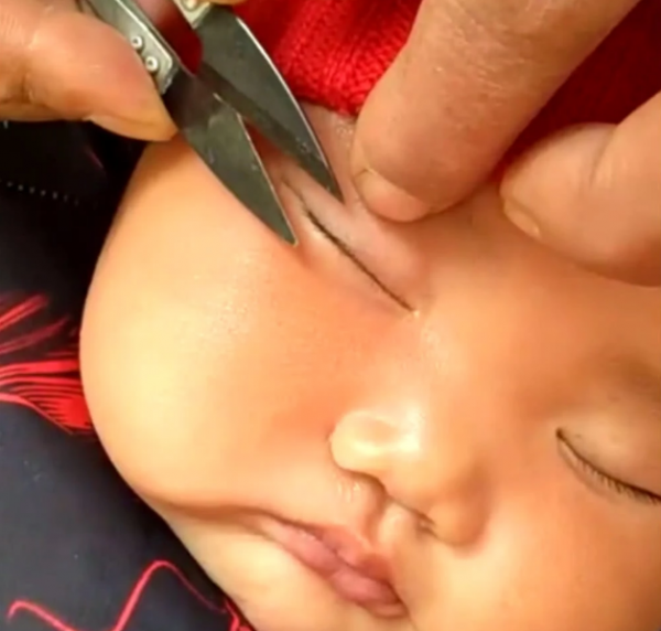 嬰兒身上這三種&OpenCurlyDoubleQuote;毛髮&rdquo;不要亂剪亂刮，會影響孩子的顏值和健康