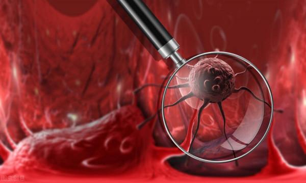 膽囊切除後，有哪些後遺症？提醒：這5種&OpenCurlyDoubleQuote;結局&rdquo;不好受，瞭解下