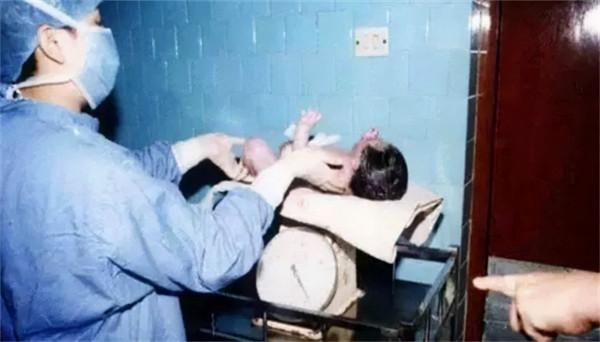 中國首例試管嬰兒鄭萌珠,31年後,在出生時的產房誕下一健康女嬰 中國首例試管嬰兒鄭萌珠,31年後,在出生時的產房誕下一健康女嬰