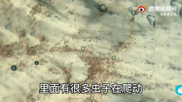 在不注意,你肚子裡就全是蟲了…… 在不注意,你肚子裡就全是蟲了……