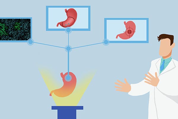 實錘！幽門螺桿菌被列為明確致癌物，4個問題需瞭解，建議收藏