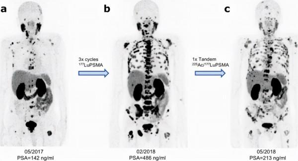 2021年MSK斯隆十大科研突破，包括白血病、肺癌、胰腺癌等領域