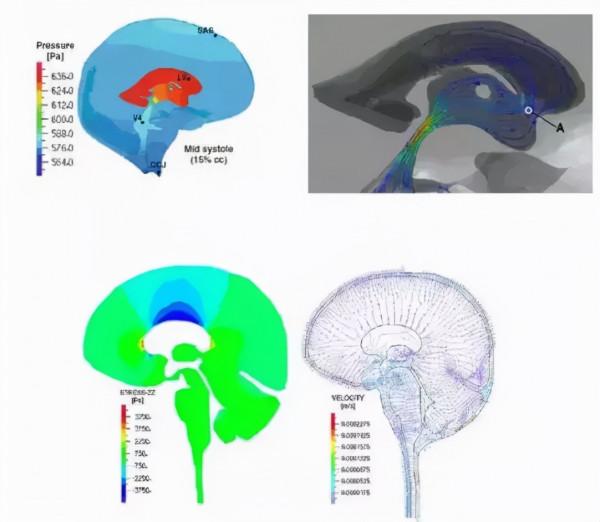 人體組織三維建模技術與有限元分析 人體組織三維建模技術與有限元分析