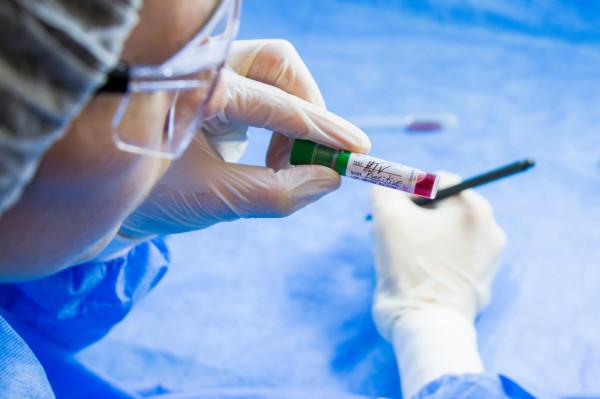 艾滋病能被徹底治癒了？全球首例被&OpenCurlyDoubleQuote;治癒&rdquo;的女患者誕生