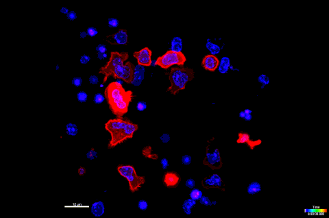 《科學》：重新整理認知！科學家首次發現，殺傷性T細胞持久的抗癌能力竟然有賴於線粒體的翻譯能力，而不是線粒體的代謝供能能力丨科學大發現