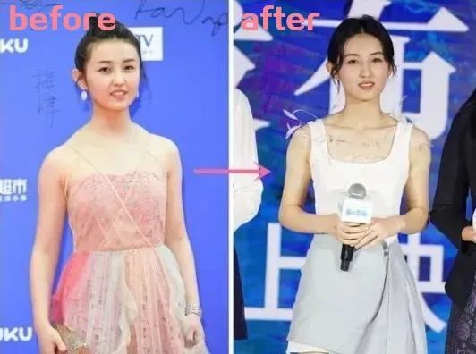 想擁有子楓妹妹同款的直角肩嘛？斜方肌還會越來越大？