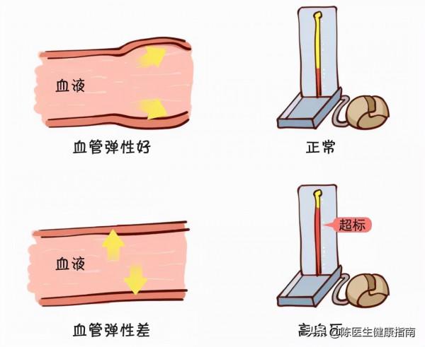 老年人脈壓很大是什麼原因？有哪些危害？該如何治療？