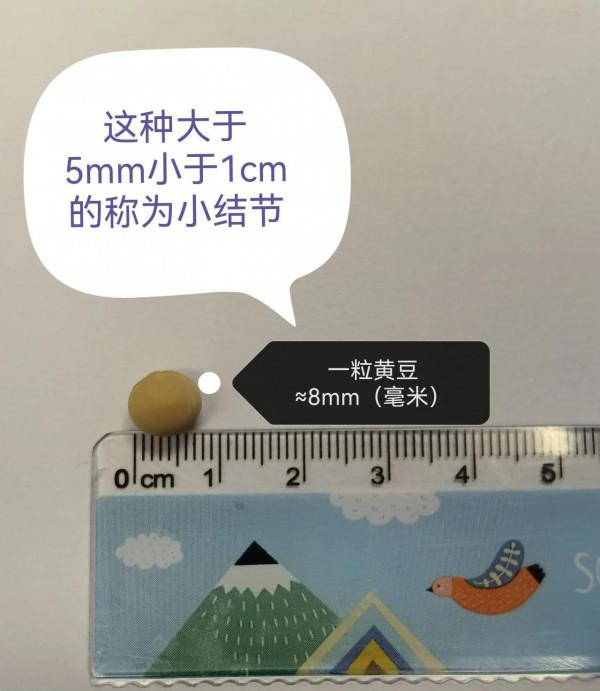 肺結節，“結友”們所關心的&quot;大小&quot;實物對照圖