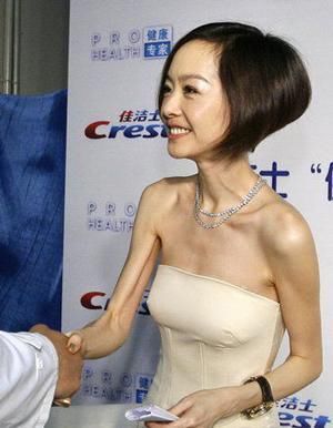 因患厭食症而暴瘦的10大女星,有的瘦成紙片人,有的因病去世 因患厭食症而暴瘦的10大女星,有的瘦成紙片人,有的因病去世