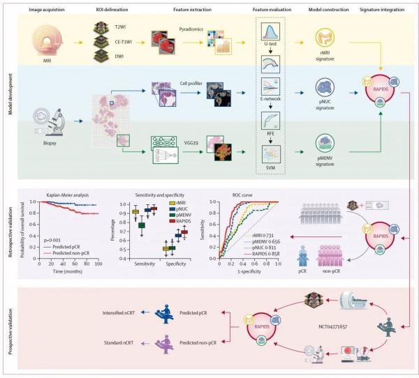作者解讀 | 人工智慧預測直腸癌新輔助放化療療效：開創整合多模態特徵預測新模式