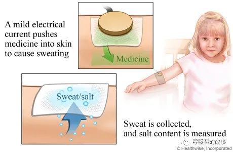 反覆發作鼻竇炎、咳嗽、支氣管擴張,這個病我們要提高認識 反覆發作鼻竇炎、咳嗽、支氣管擴張,這個病我們要提高認識
