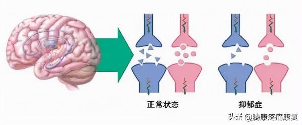 長期運動我們的大腦是這樣變化的