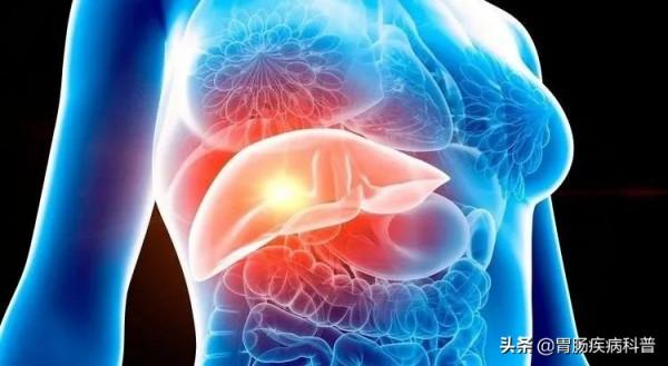 體檢查出囊腫、結節、息肉，啥樣的才是癌症的近親？