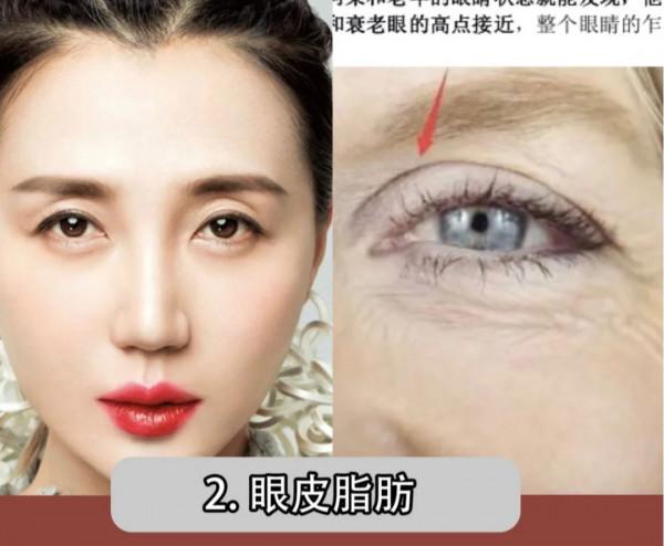 “耐老臉”的四個特徵,你有嗎? “耐老臉”的四個特徵,你有嗎?