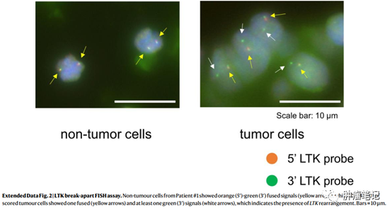 非小細胞肺癌治療新靶點