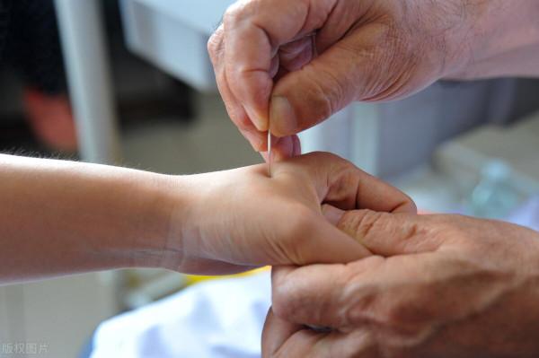 高血壓可以針灸嗎？針灸科醫生：針灸配合中藥，這樣治效果還不錯