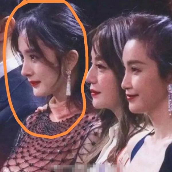 楊冪&OpenCurlyDoubleQuote;拔牙後遺症&rdquo;犯了！打臉說整容的人，粉絲：這毛病可以接受