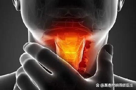 慢性咽喉炎主要有五大表現症狀