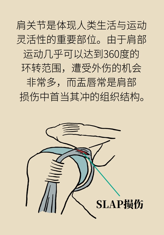 健身房裡最常發生的肩痛，該怎麼應對？