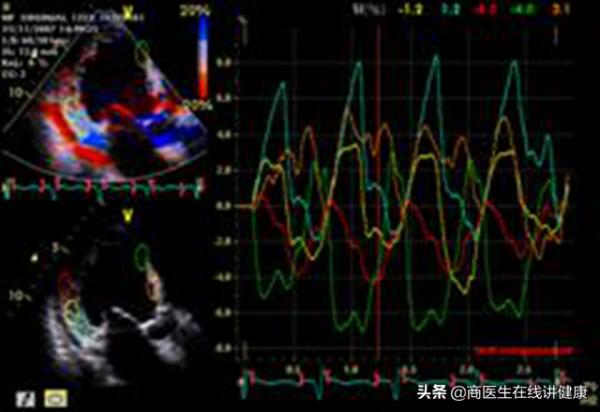 心臟病就吃丹參片?你可能用錯藥!醫生教你冠心病如何正確治 心臟病就吃丹參片?你可能用錯藥!醫生教你冠心病如何正確治