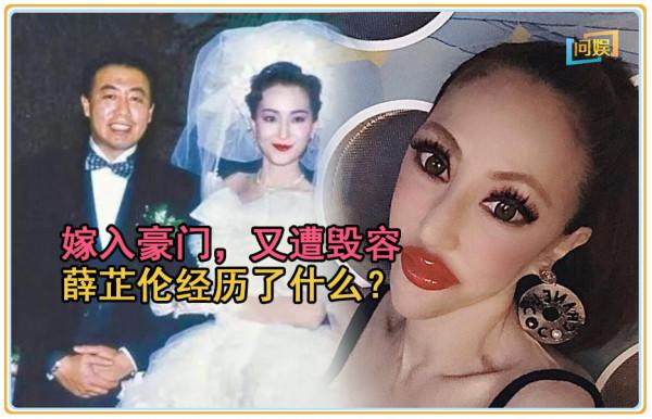 繼承鉅額遺產後嫁入豪門，又遭毀容，闊太薛芷倫經歷了什麼？