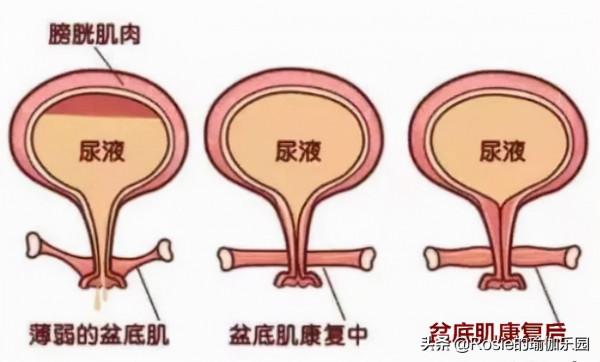 產後五臟六腑位置都不對？產後修復如何做？超模私教帶你這樣練