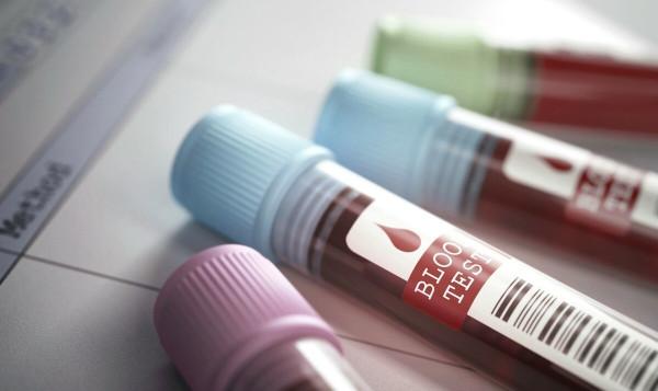 甘油三酯升高，對人體危害大嗎，到什麼程度要吃藥？