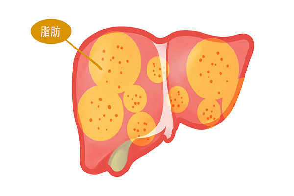逍遙丸是女性的“專用藥”?其他人不適合服用嗎?你可能想錯了 逍遙丸是女性的“專用藥”?其他人不適合服用嗎?你可能想錯了