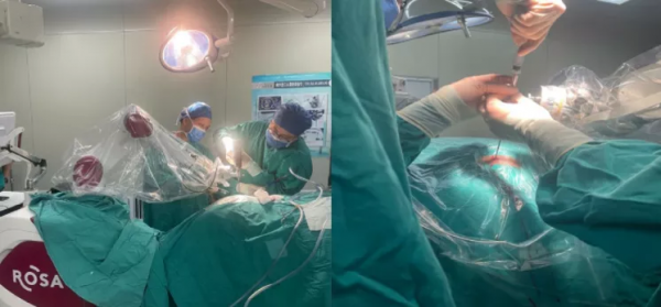 廣西首臺ROSA二代機器人落戶自治區人民醫院