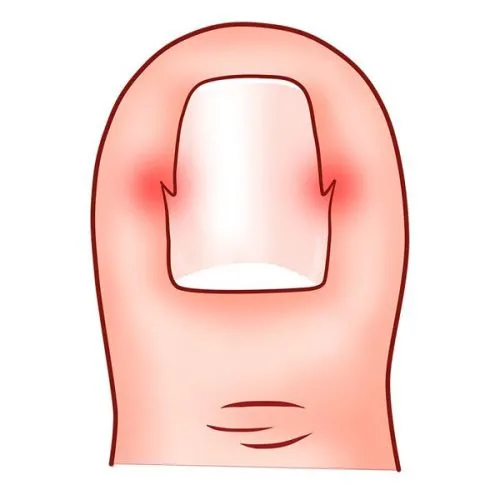 給寶寶剪指甲太難了!竟然剪錯那麼多年 給寶寶剪指甲太難了!竟然剪錯那麼多年