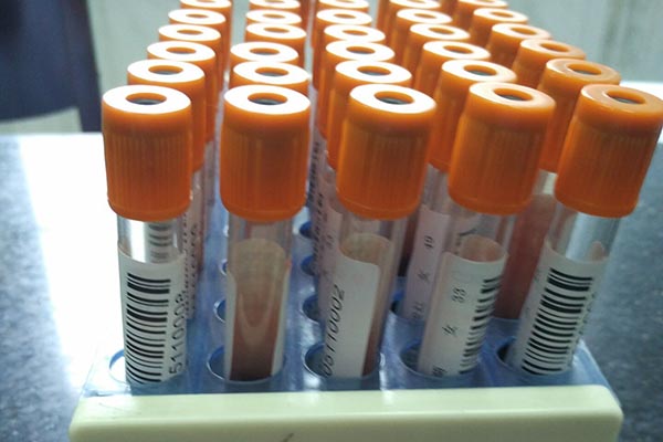 乙肝患者，長期吃恩替卡韋，需做哪些檢查？關於恩替卡韋幾點須知