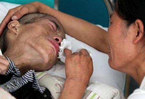 癌症真的會“遺傳”嗎？