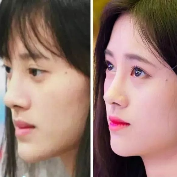 娛樂圈這8位女星被整容毀掉，有人臉僵如石，有的“堪比換頭”