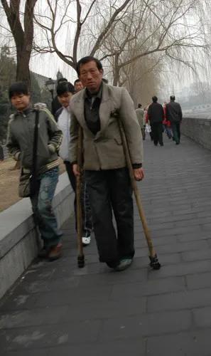 鄉村趣聞——瘸子阿振